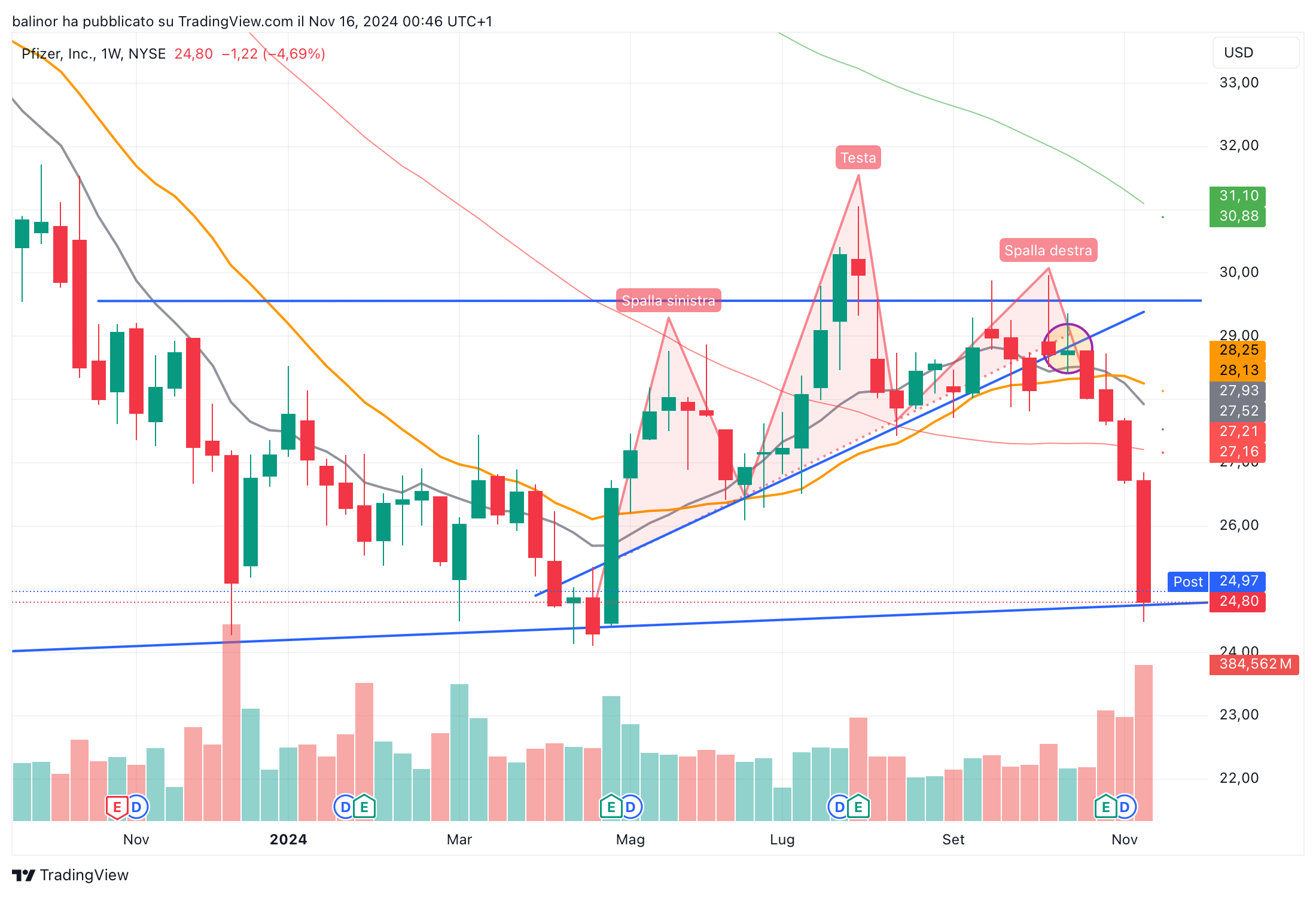 BATS:PFE Chart Image by balinor