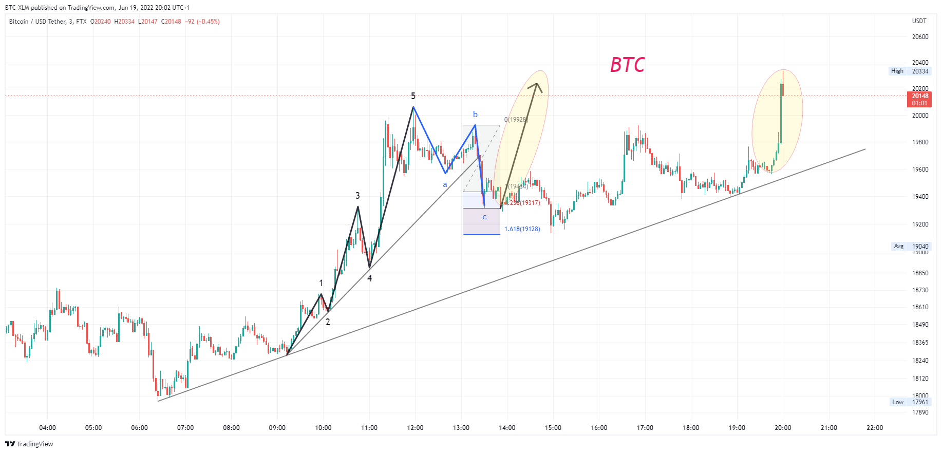 FTX:BTCUSDT Chart Image by BTC-XLM