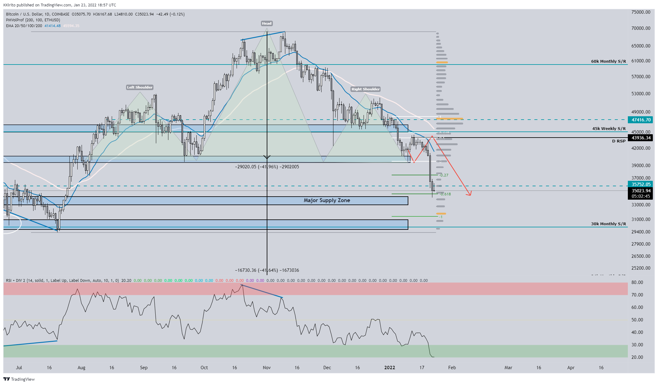 COINBASE:BTCUSD Chart Image by KKirito