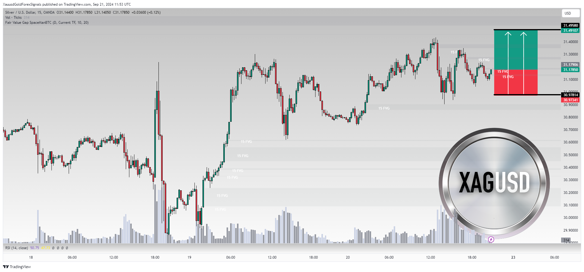 OANDA:XAGUSD Chart Image by XauusdGoldForexSignals