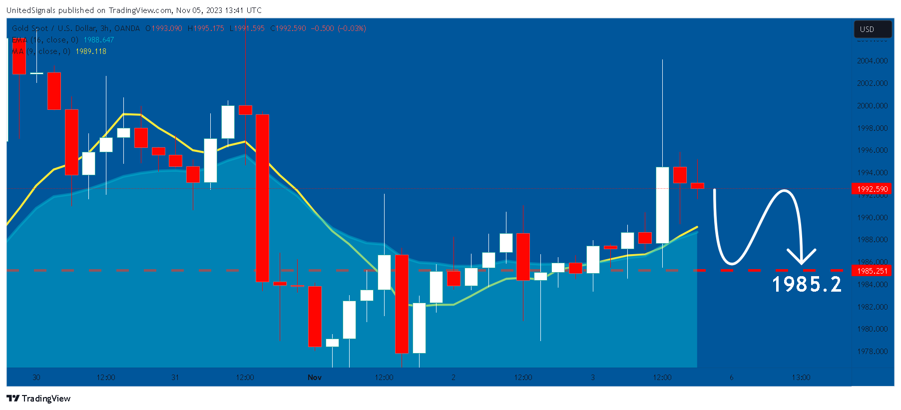 OANDA:XAUUSD Chart Image by UnitedSignals