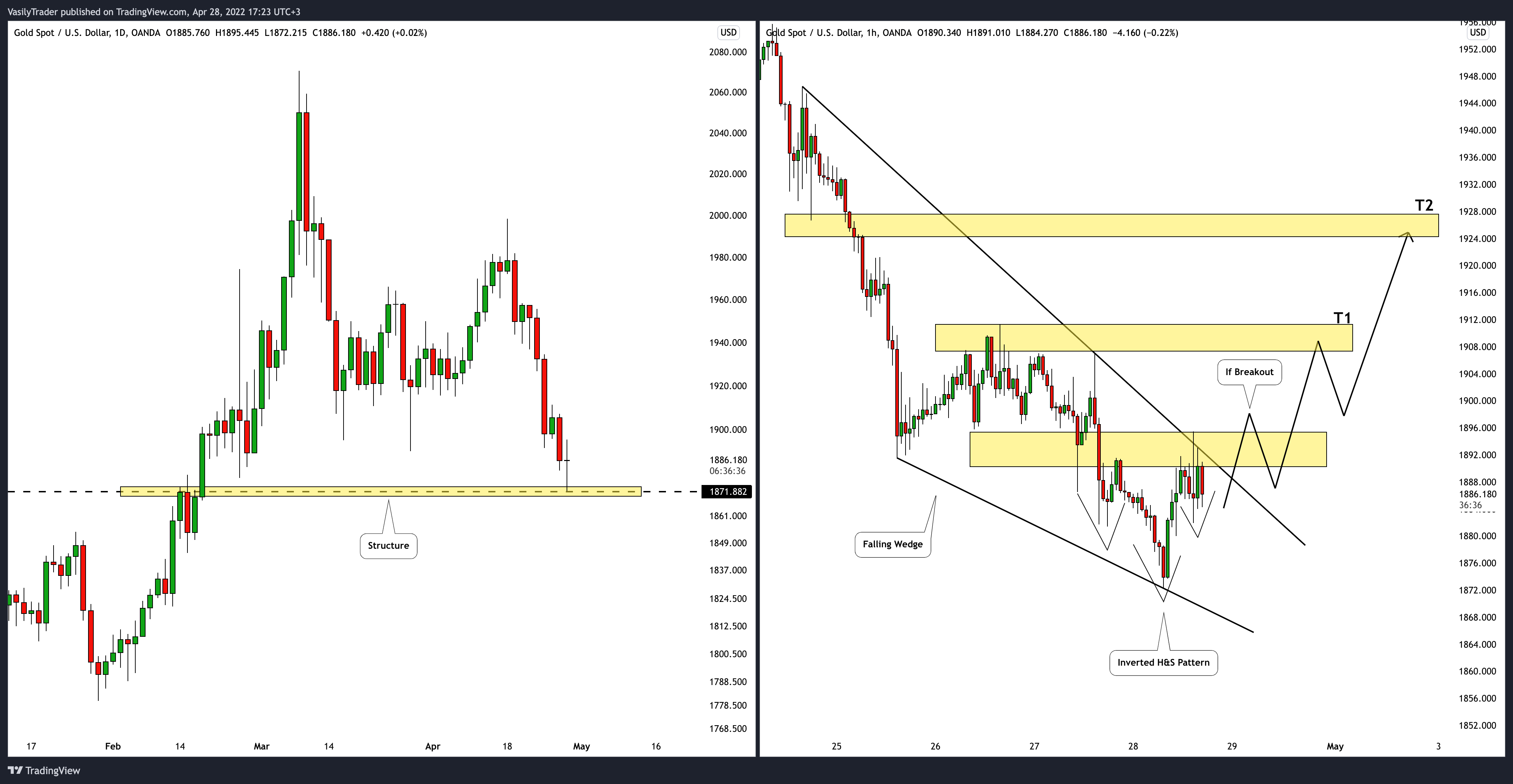 OANDA:XAUUSD Chart Image by VasilyTrader