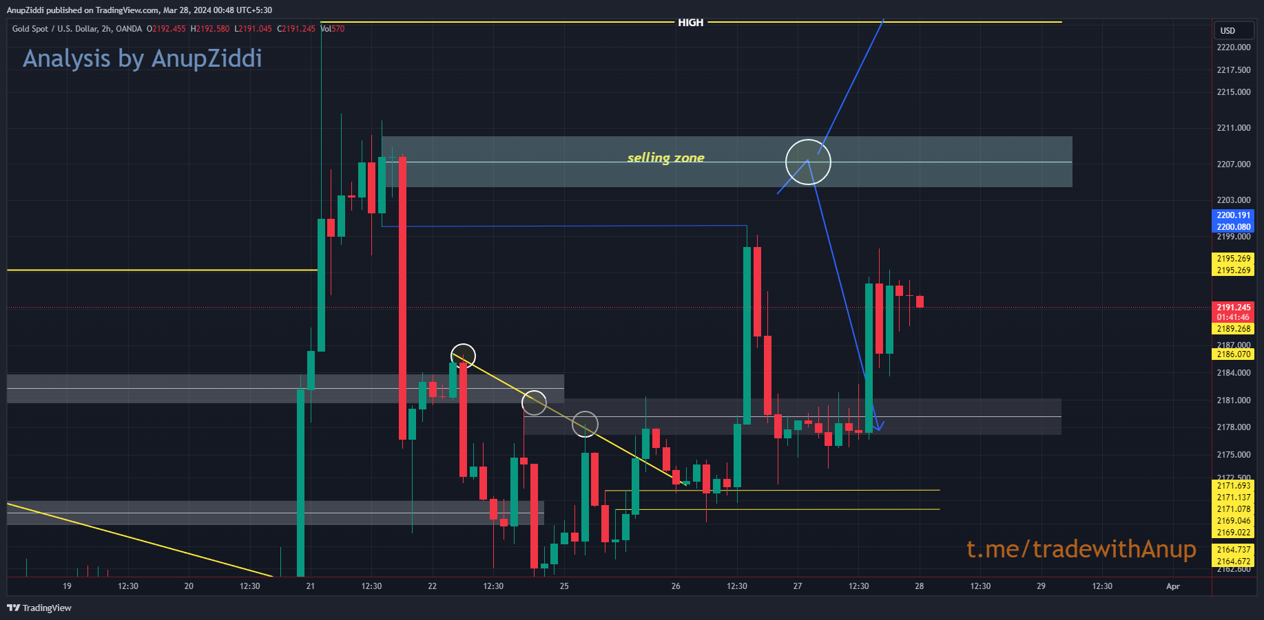 OANDA:XAUUSD Chart Image by AnupZiddi