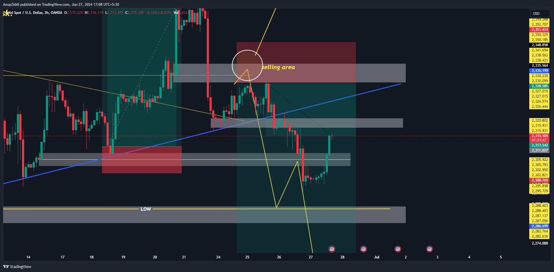 OANDA:XAUUSD Chart Image by AnupZiddi