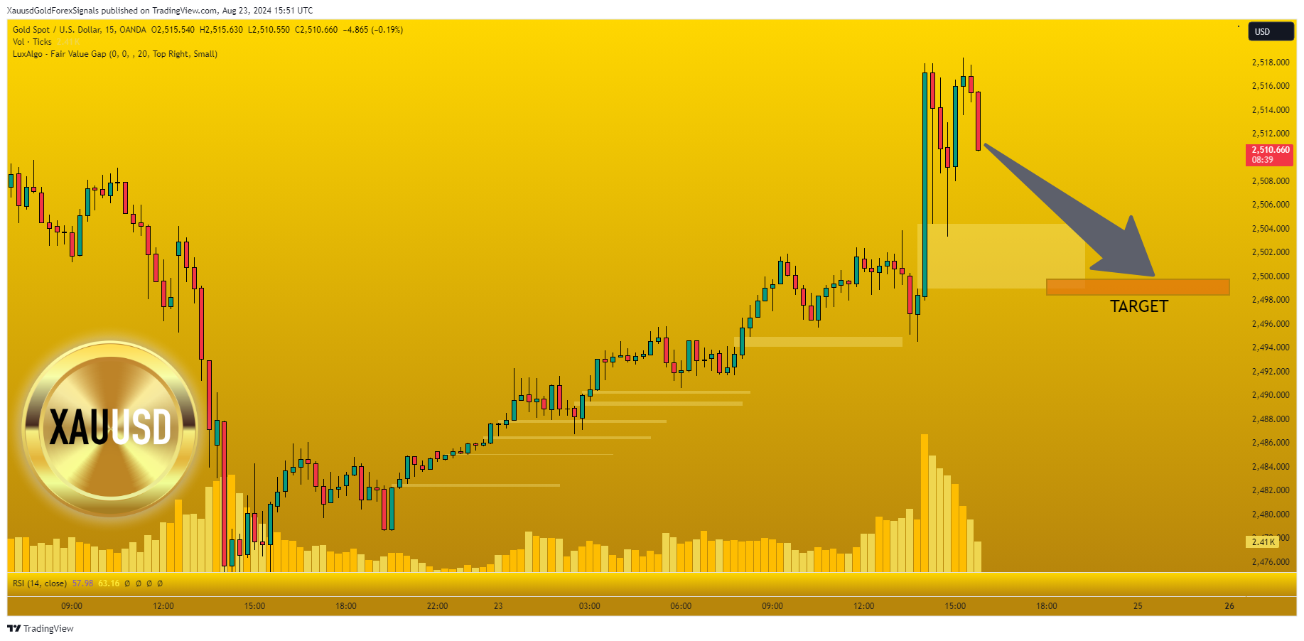 OANDA:XAUUSD Chart Image by XauusdGoldForexSignals