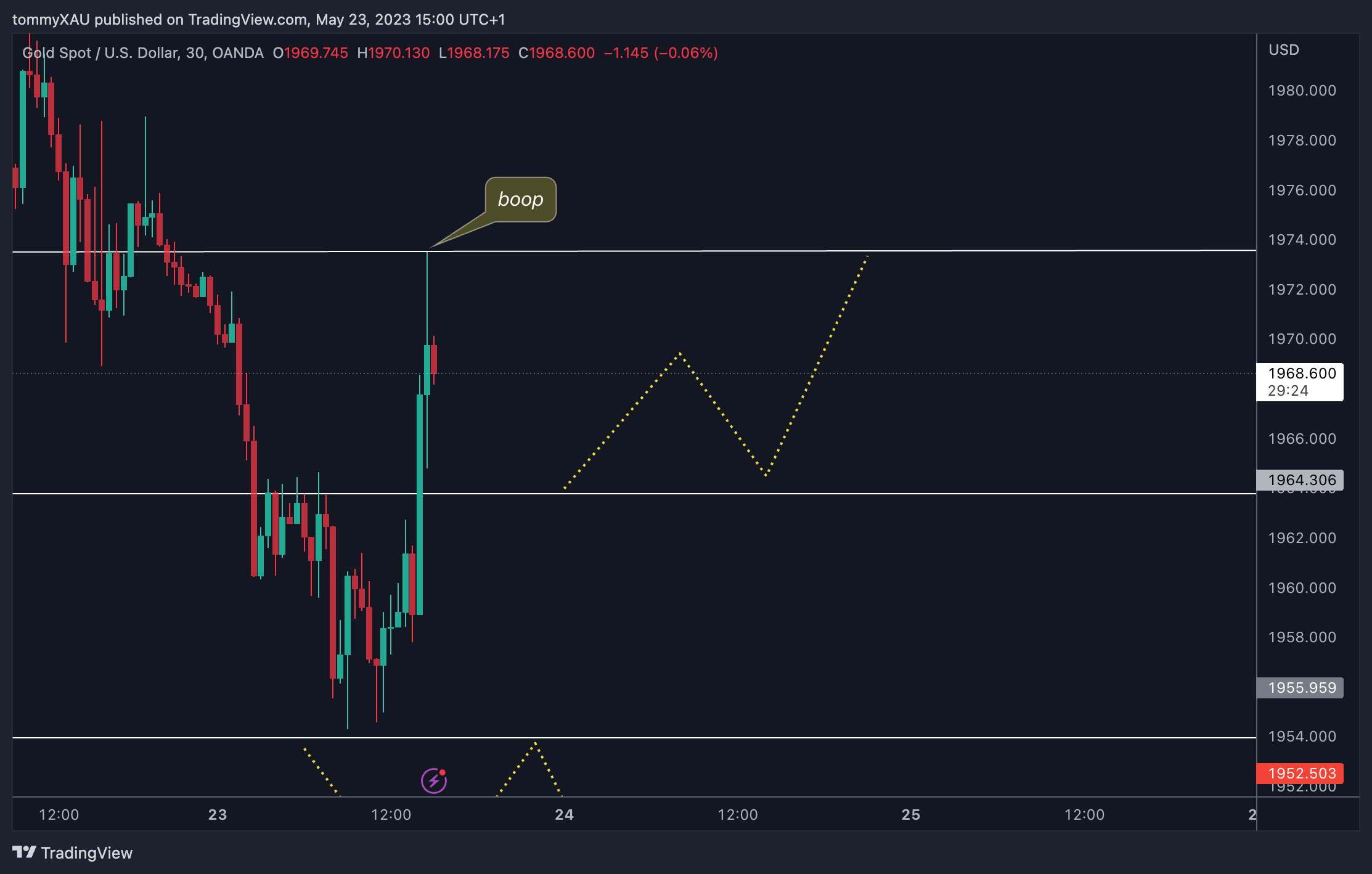 OANDA:XAUUSD Chart Image by tommyXAU