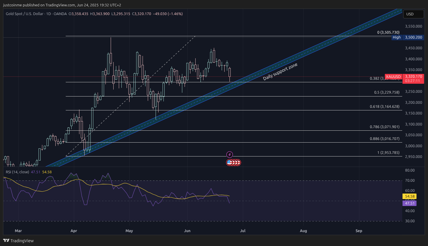 OANDA:XAUUSD Chart Image by justcoinme