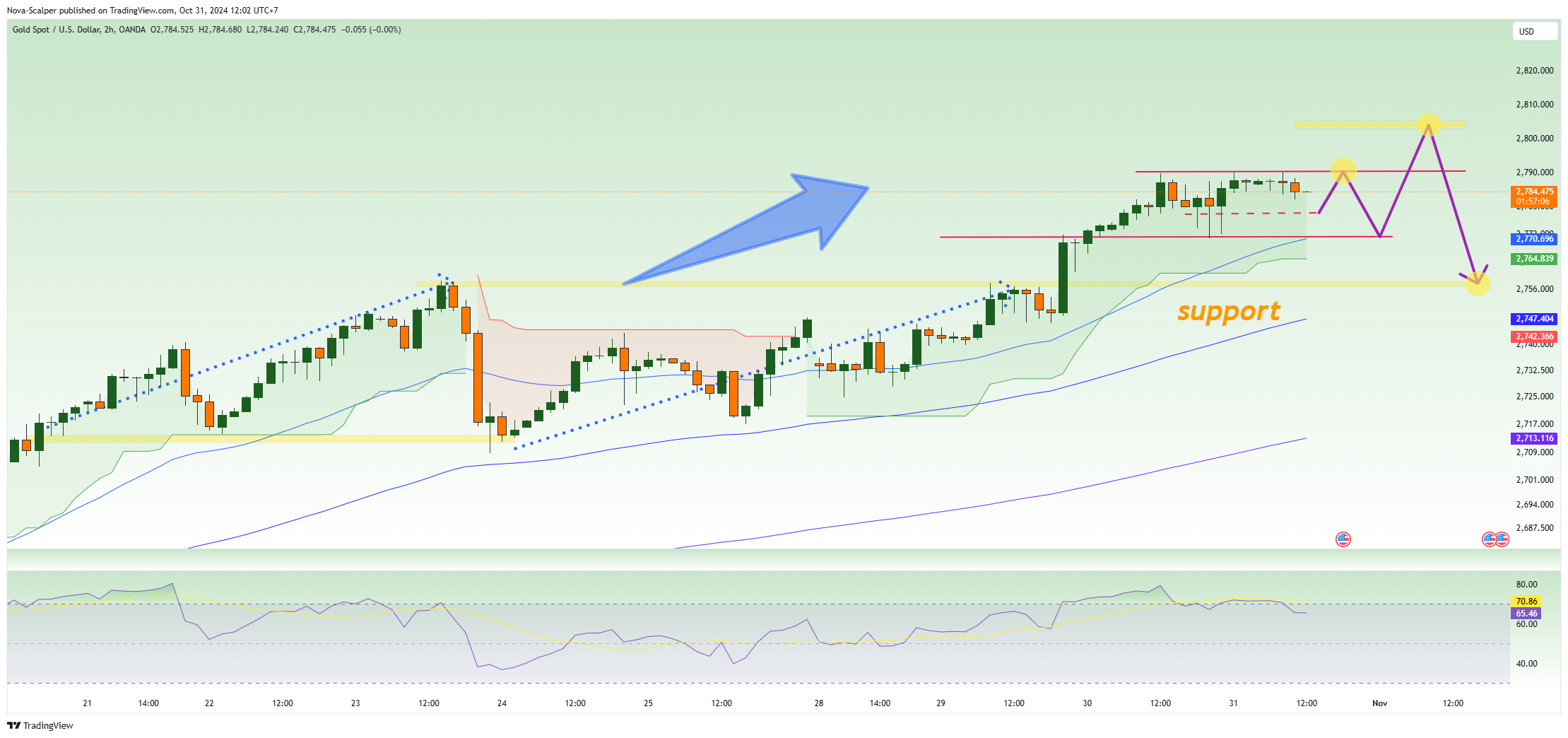 OANDA:XAUUSD Chart Image by Nova-Scalper