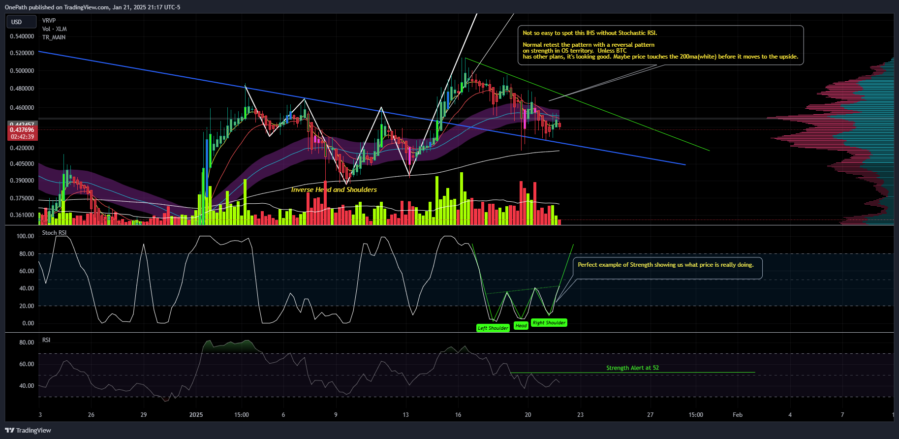 COINBASE:XLMUSD Chart Image by OnePath