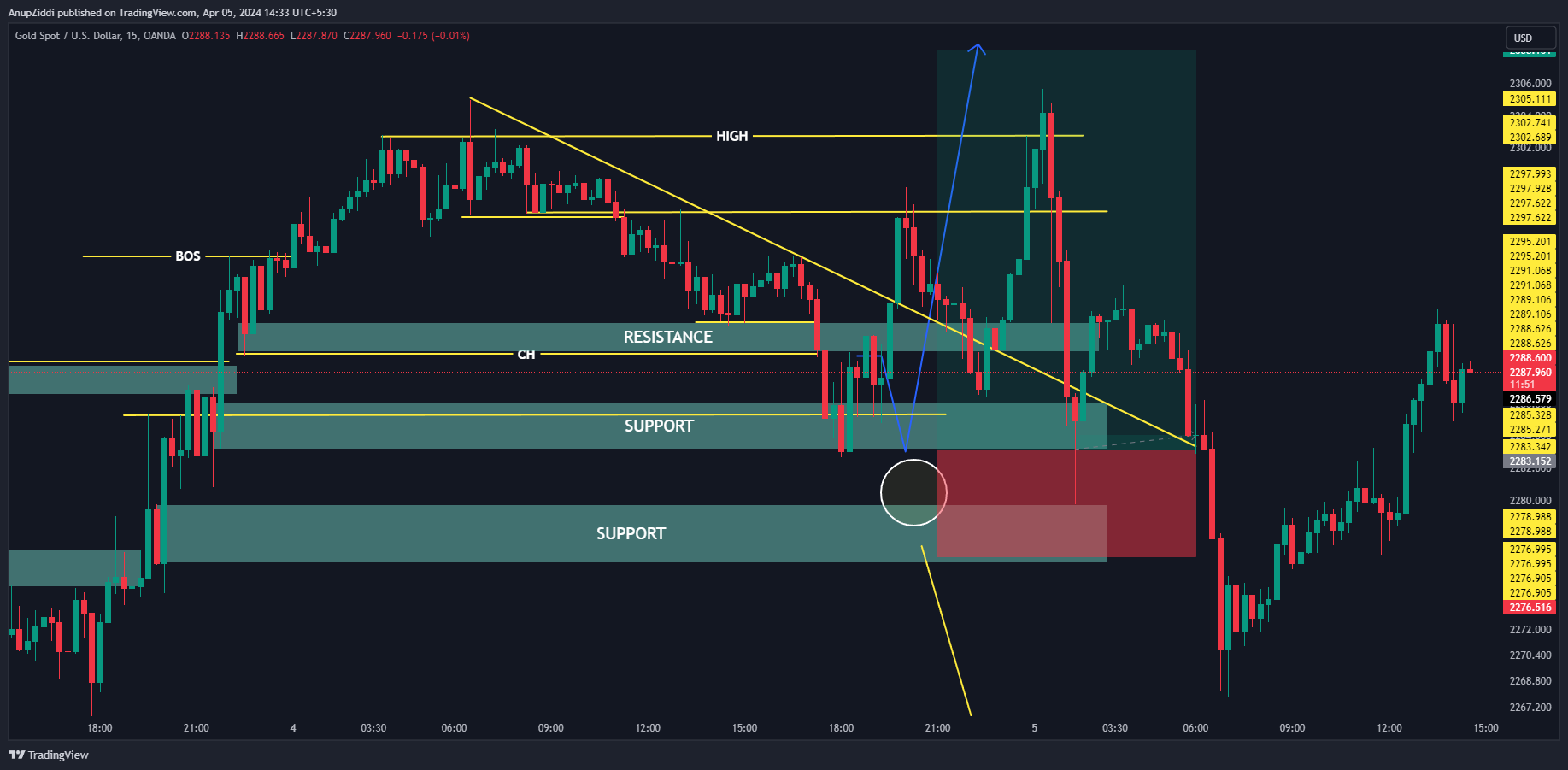 OANDA:XAUUSD Chart Image by AnupZiddi