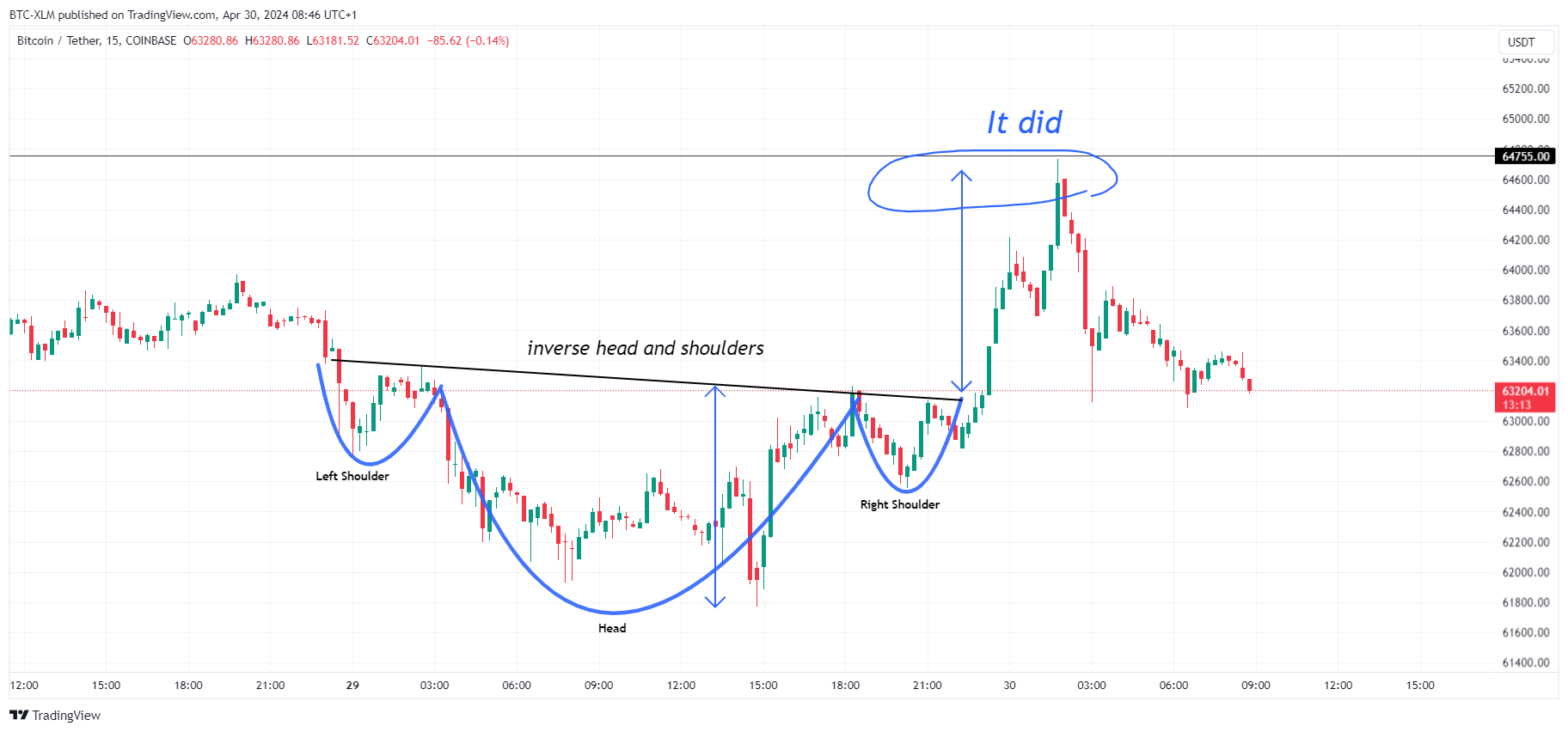COINBASE:BTCUSDT Chart Image by BTC-XLM
