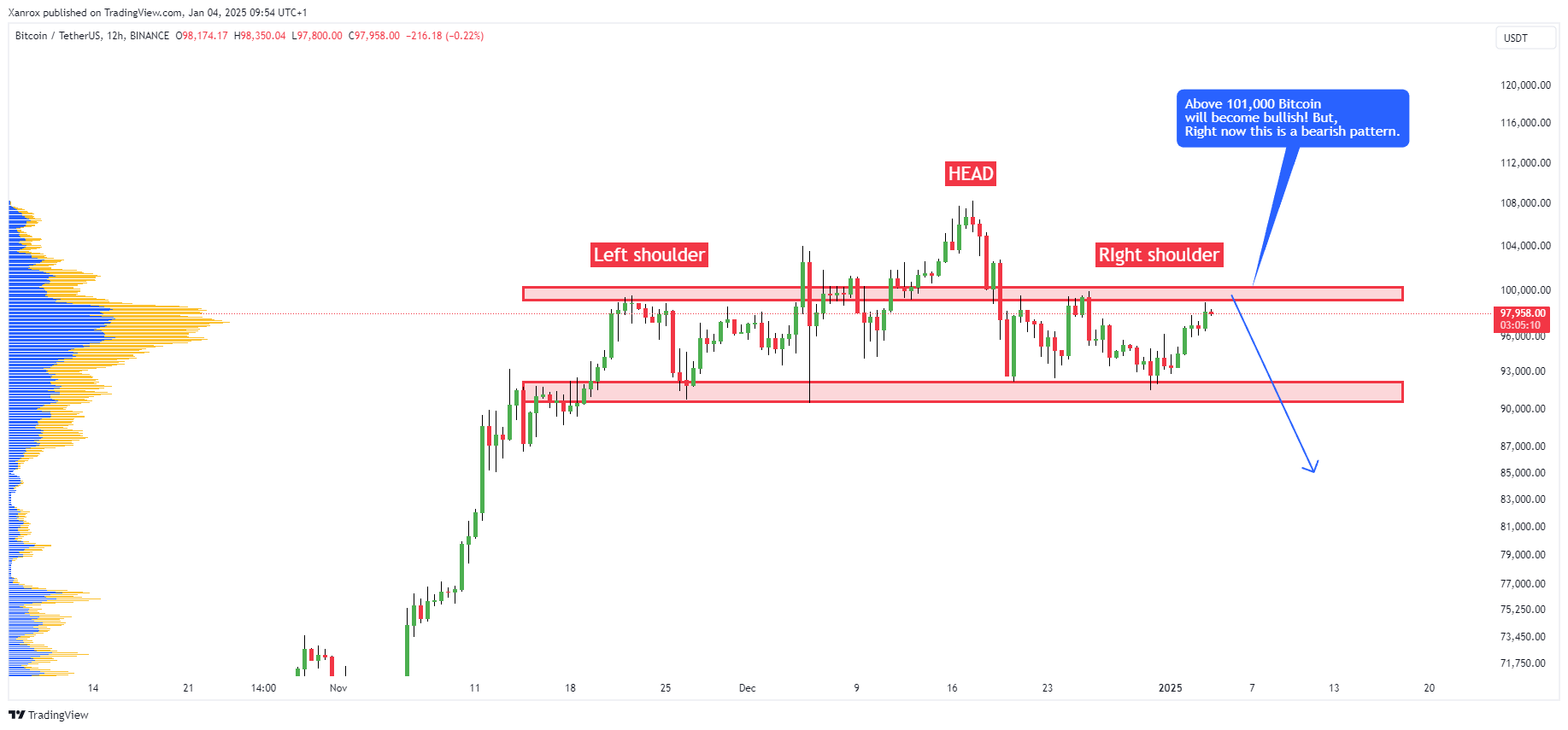 BINANCE:BTCUSDT Chart Image by Xanrox