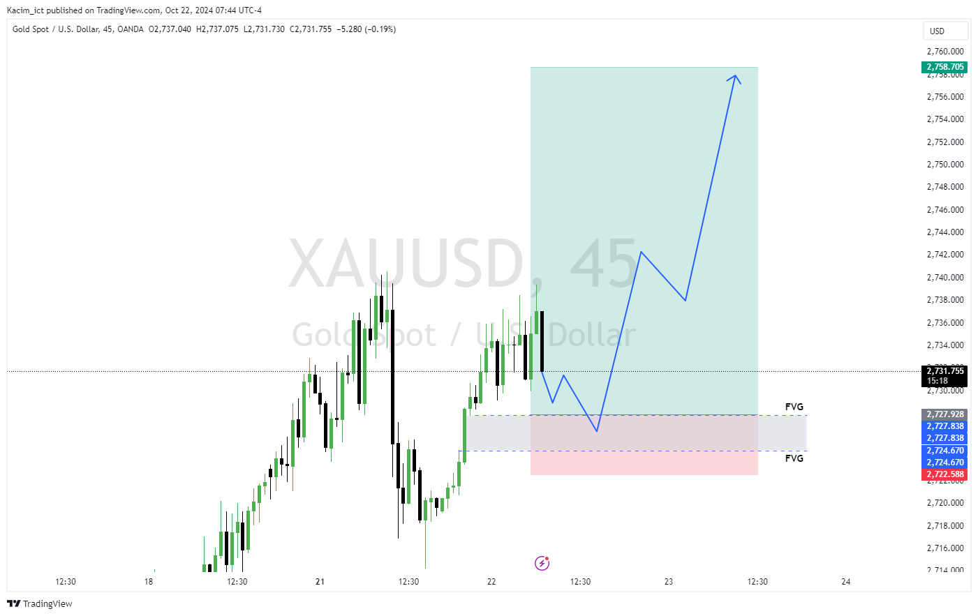 OANDA:XAUUSD Chart Image by Kacim_ict