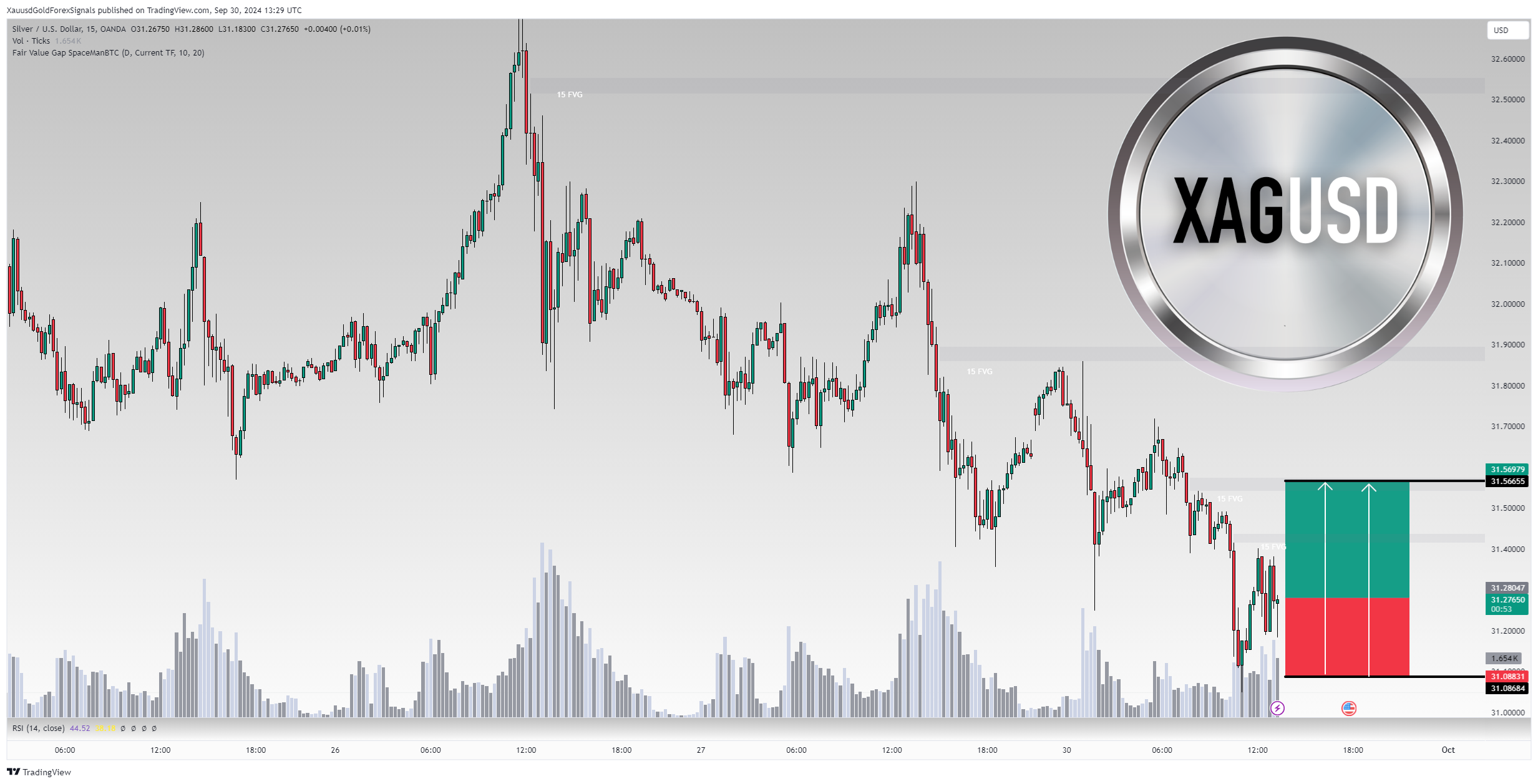 OANDA:XAGUSD Chart Image by XauusdGoldForexSignals