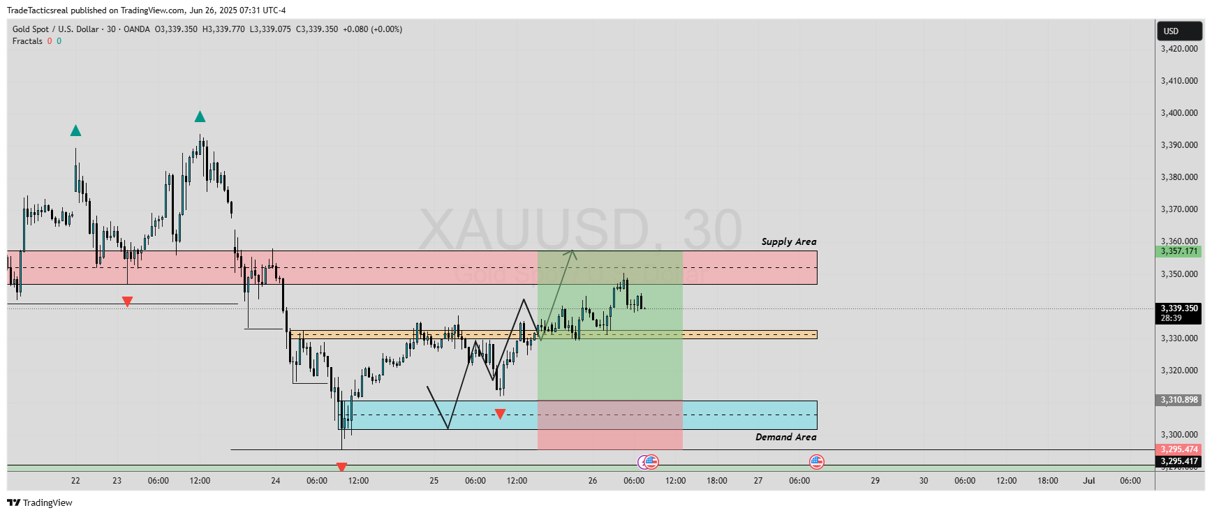 OANDA:XAUUSD Chart Image by TradeTacticsreal