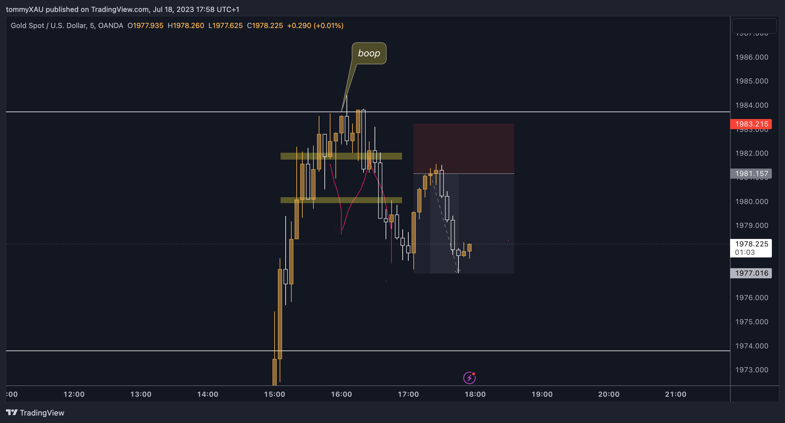 OANDA:XAUUSD Chart Image by tommyXAU
