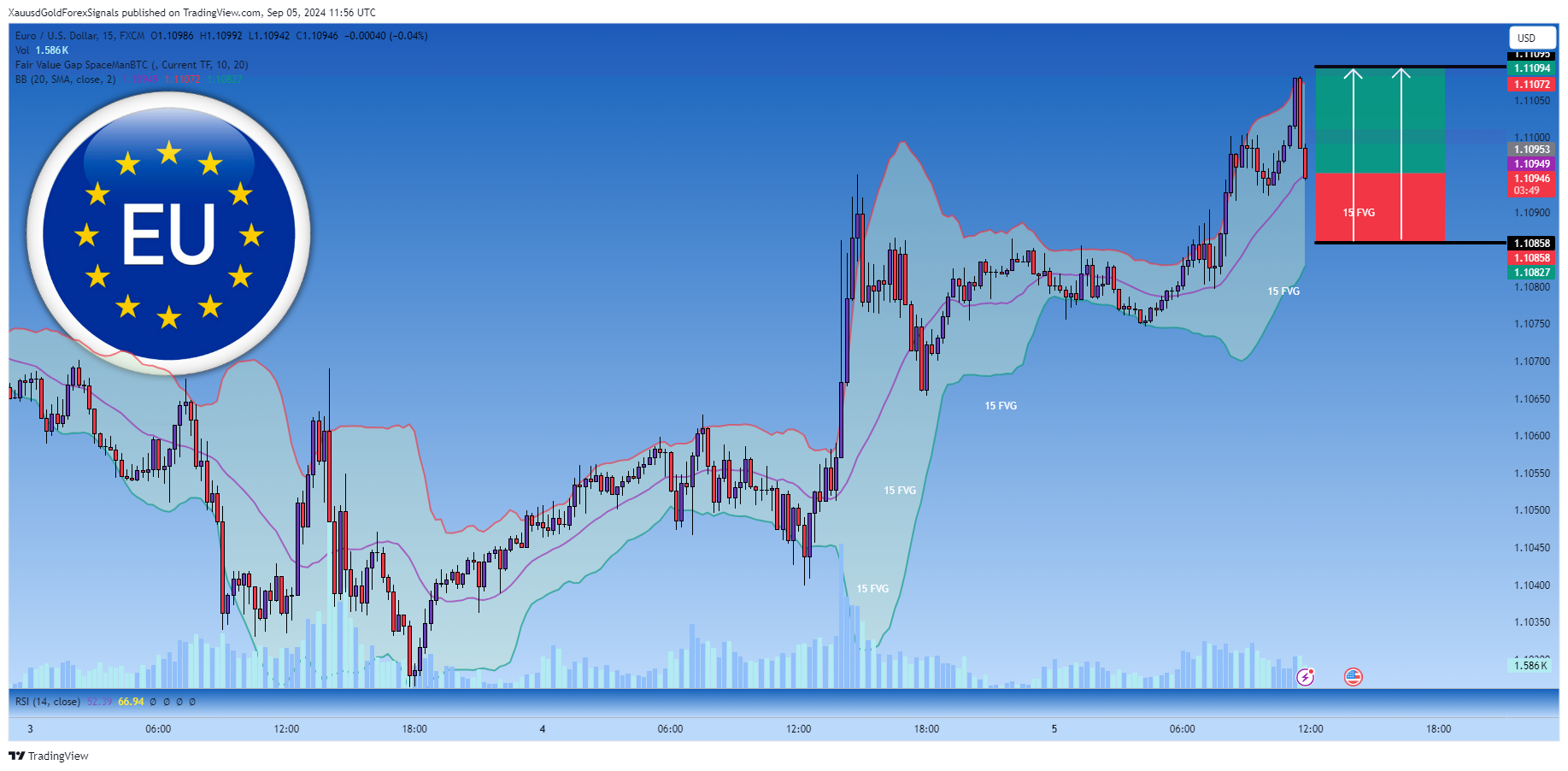 FX:EURUSD Chart Image by XauusdGoldForexSignals