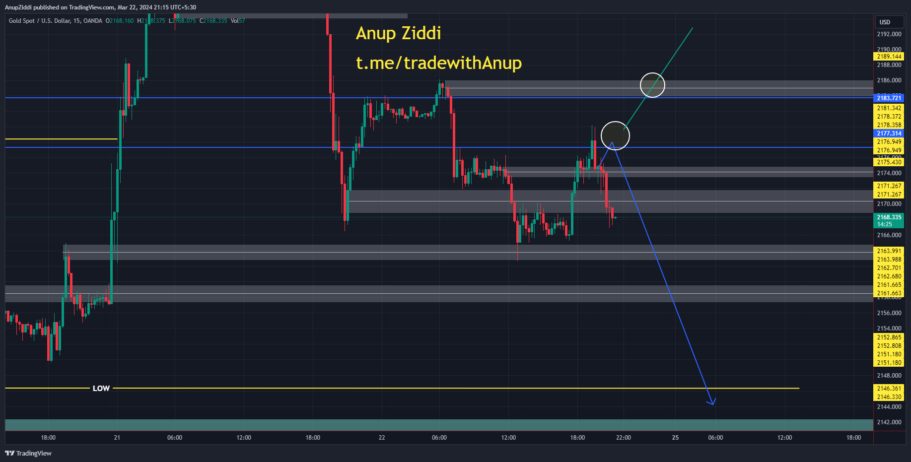 OANDA:XAUUSD Chart Image by AnupZiddi