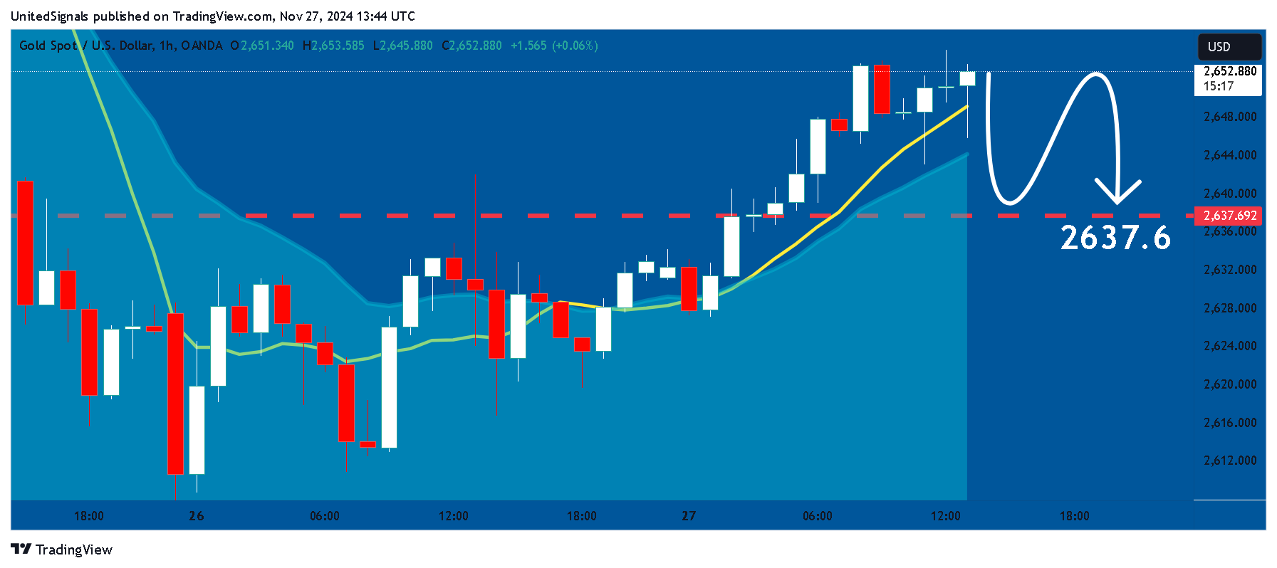 OANDA:XAUUSD Chart Image by UnitedSignals