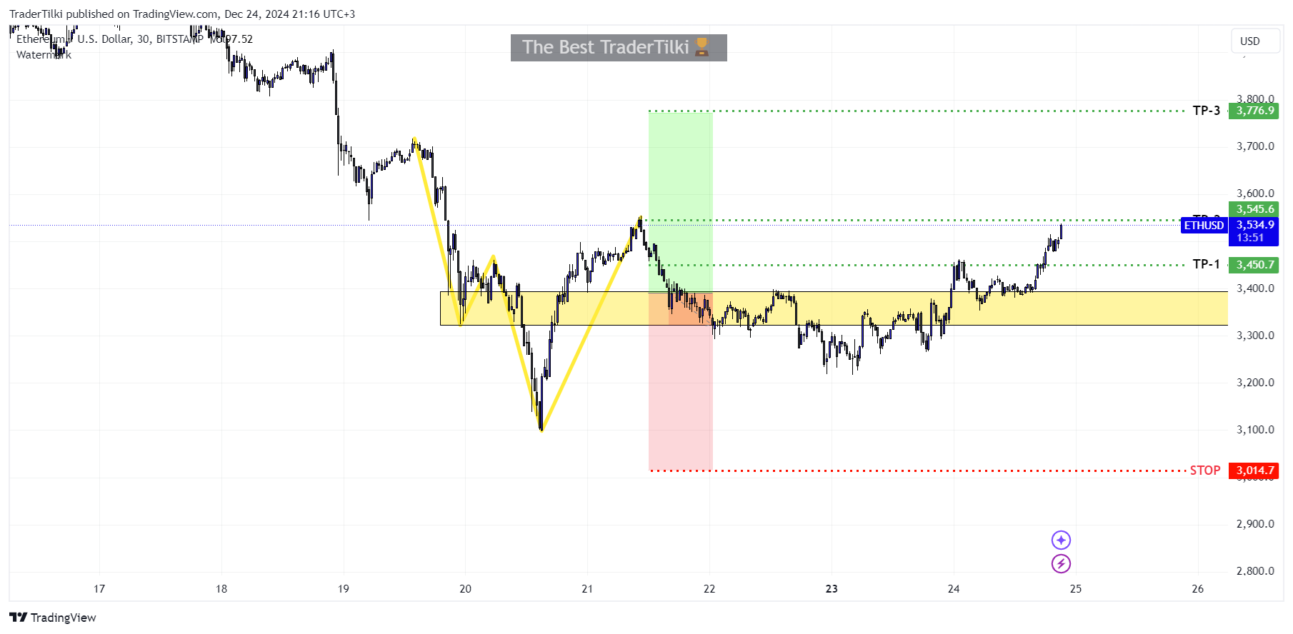 BITSTAMP:ETHUSD Chart Image by TraderTilki