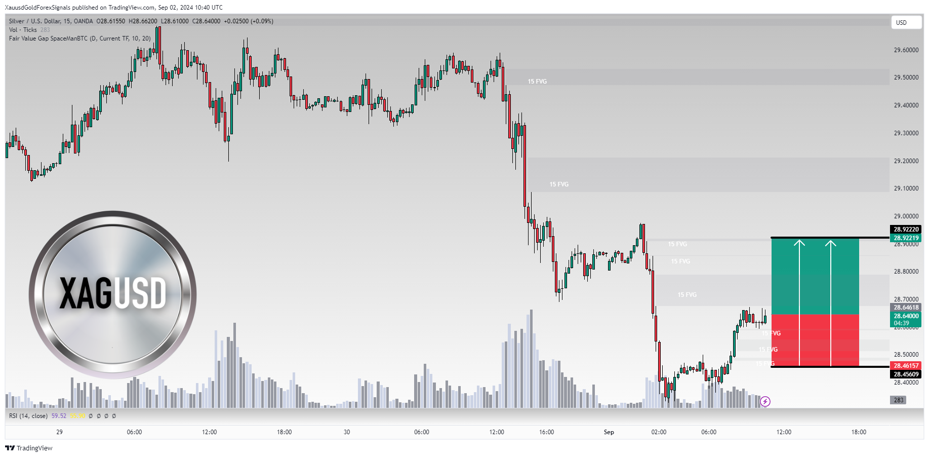 OANDA:XAGUSD Chart Image by XauusdGoldForexSignals