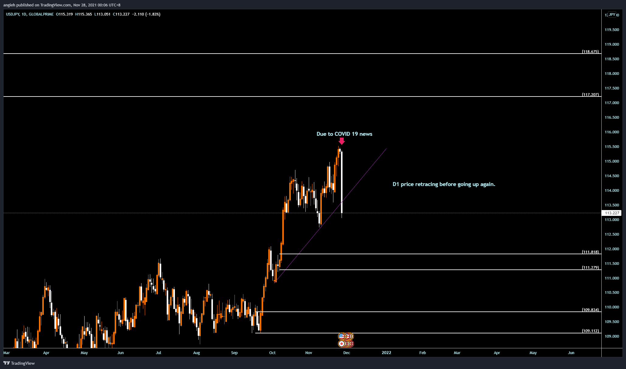 GLOBALPRIME:USDJPY Chart Image by angieh