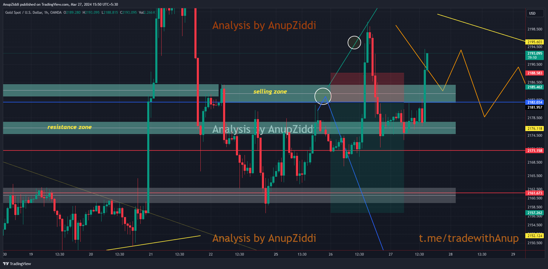 OANDA:XAUUSD Chart Image by AnupZiddi