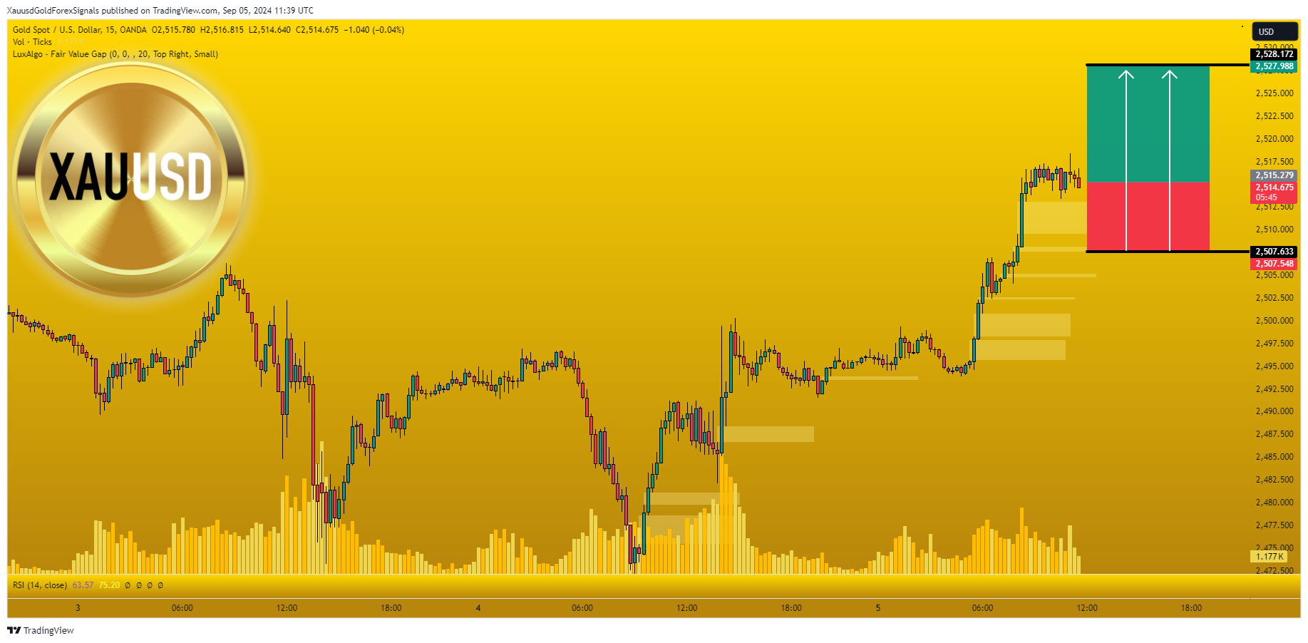 OANDA:XAUUSD Chart Image by XauusdGoldForexSignals
