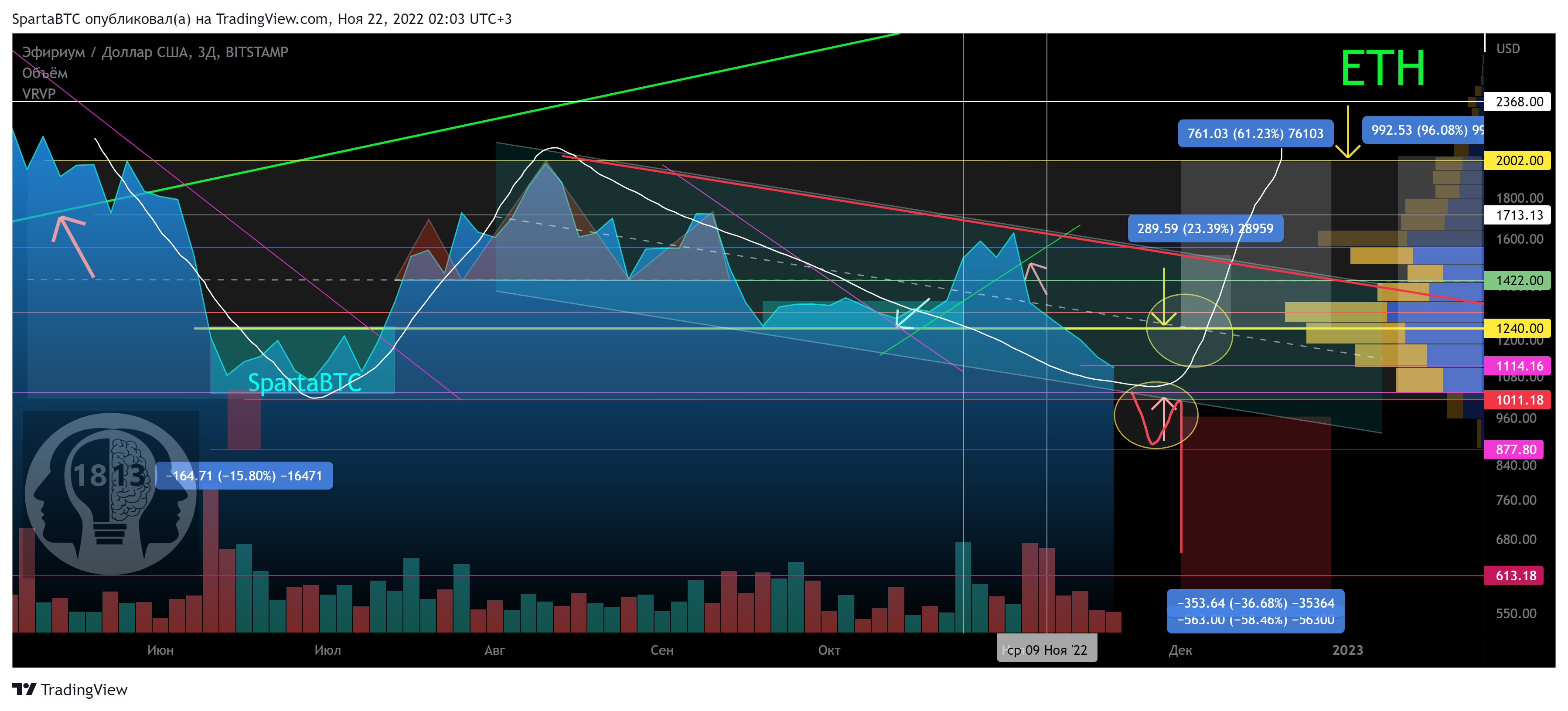 BITSTAMP:ETHUSD Chart Image by SpartaBTC