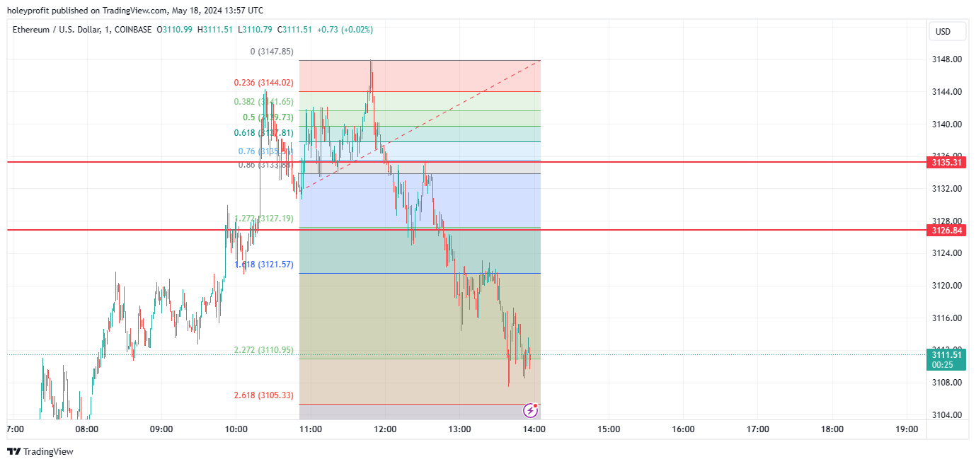 COINBASE:ETHUSD Chart Image by holeyprofit