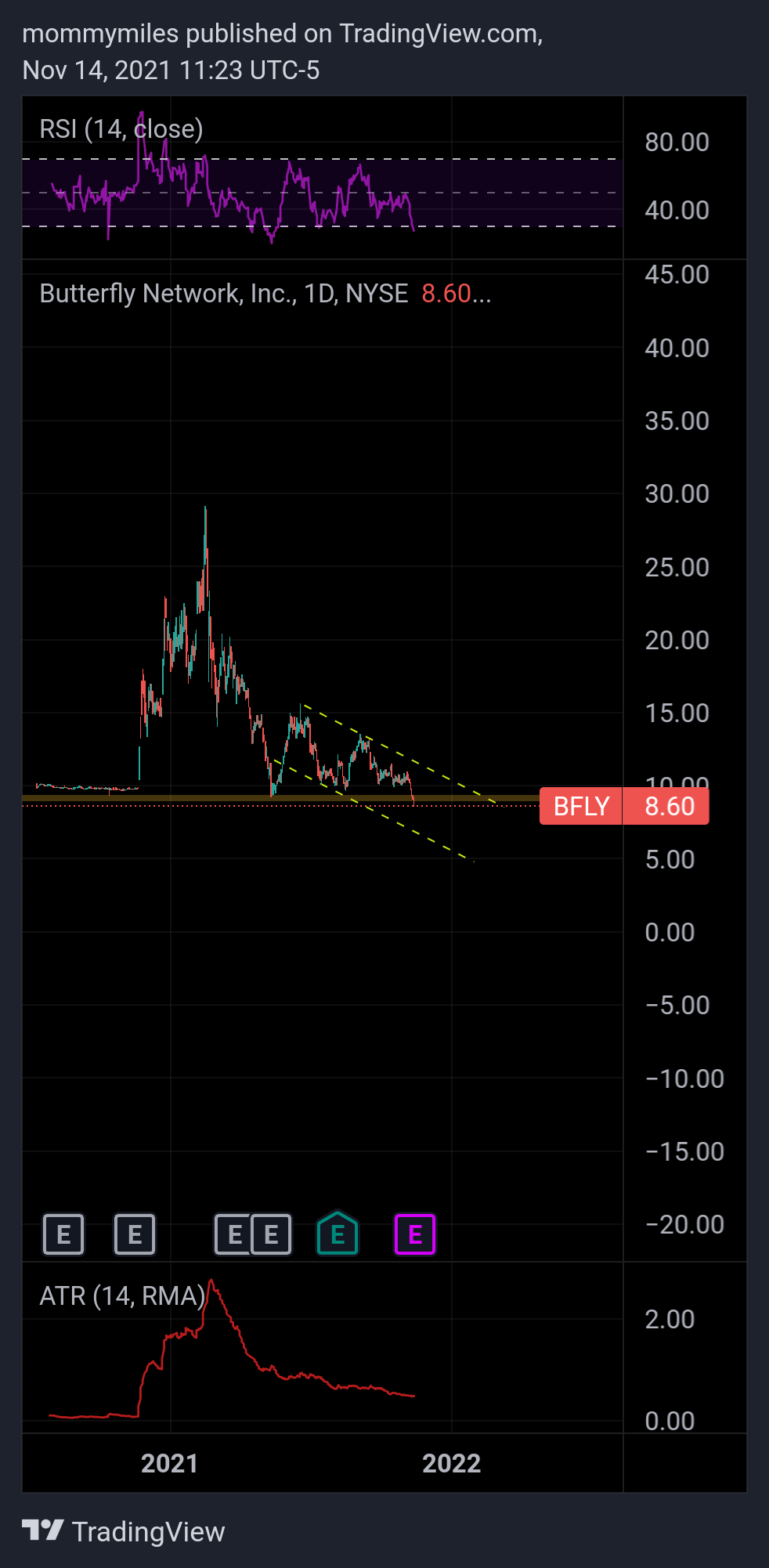 NYSE:BFLY Chart Image by mommymiles