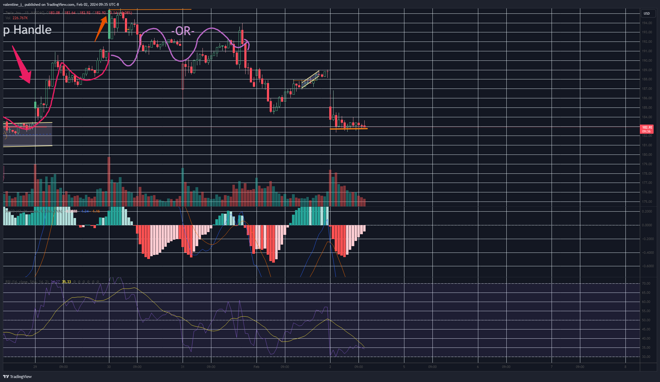 BATS:TSLA Chart Image by valentine_j_