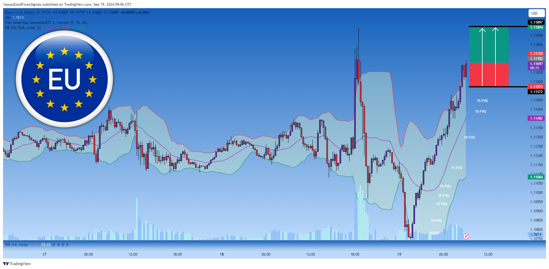 FX:EURUSD Chart Image by XauusdGoldForexSignals