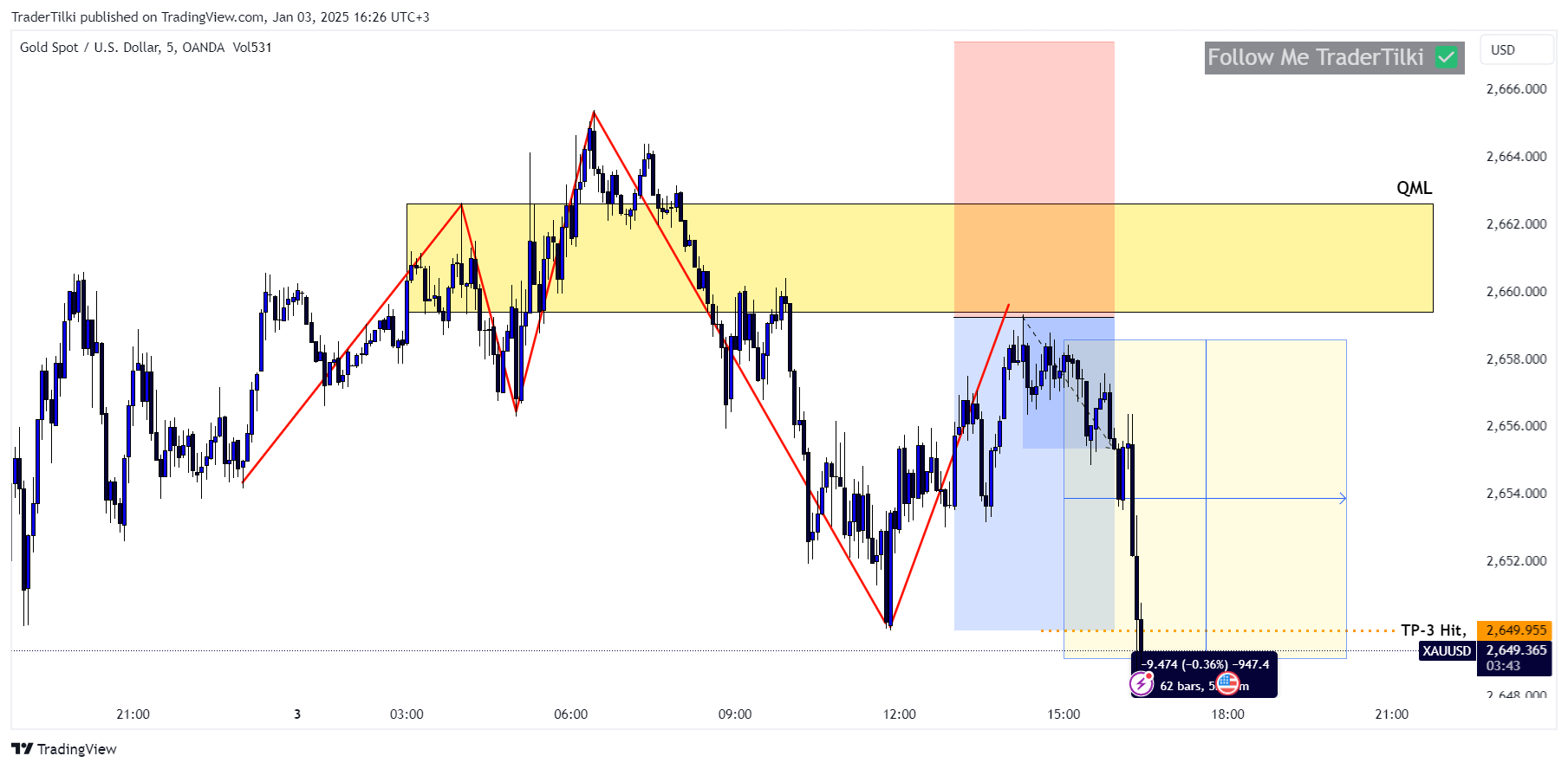 OANDA:XAUUSD Chart Image by TraderTilki