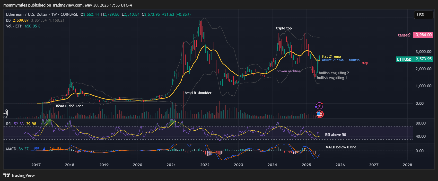 COINBASE:ETHUSD Chart Image by mommymiles