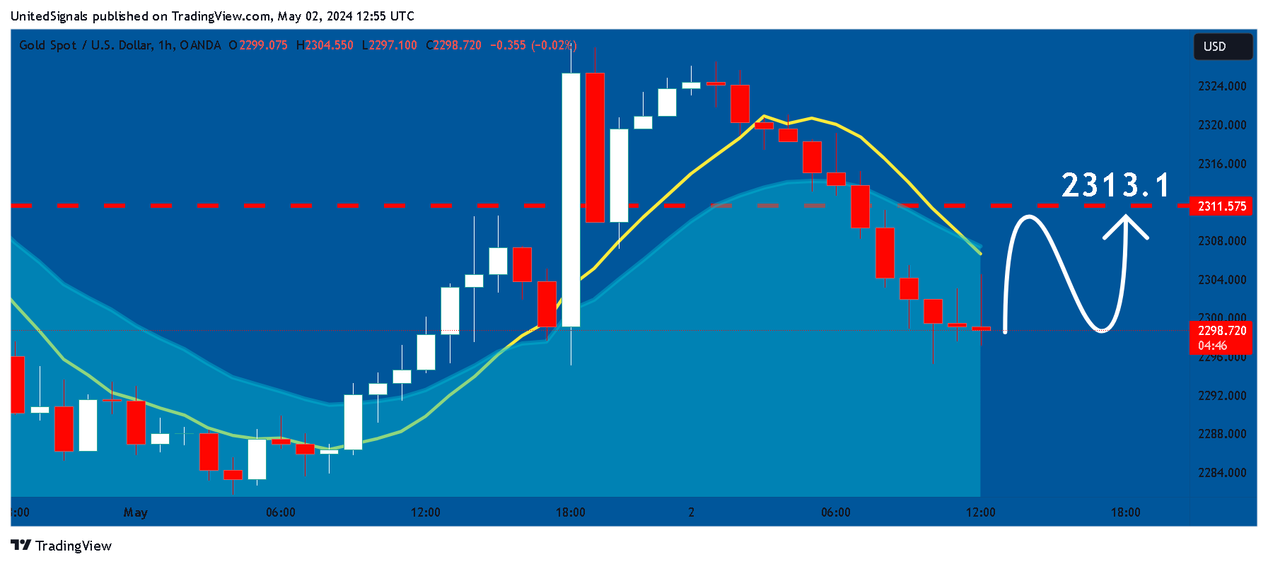OANDA:XAUUSD Chart Image by UnitedSignals