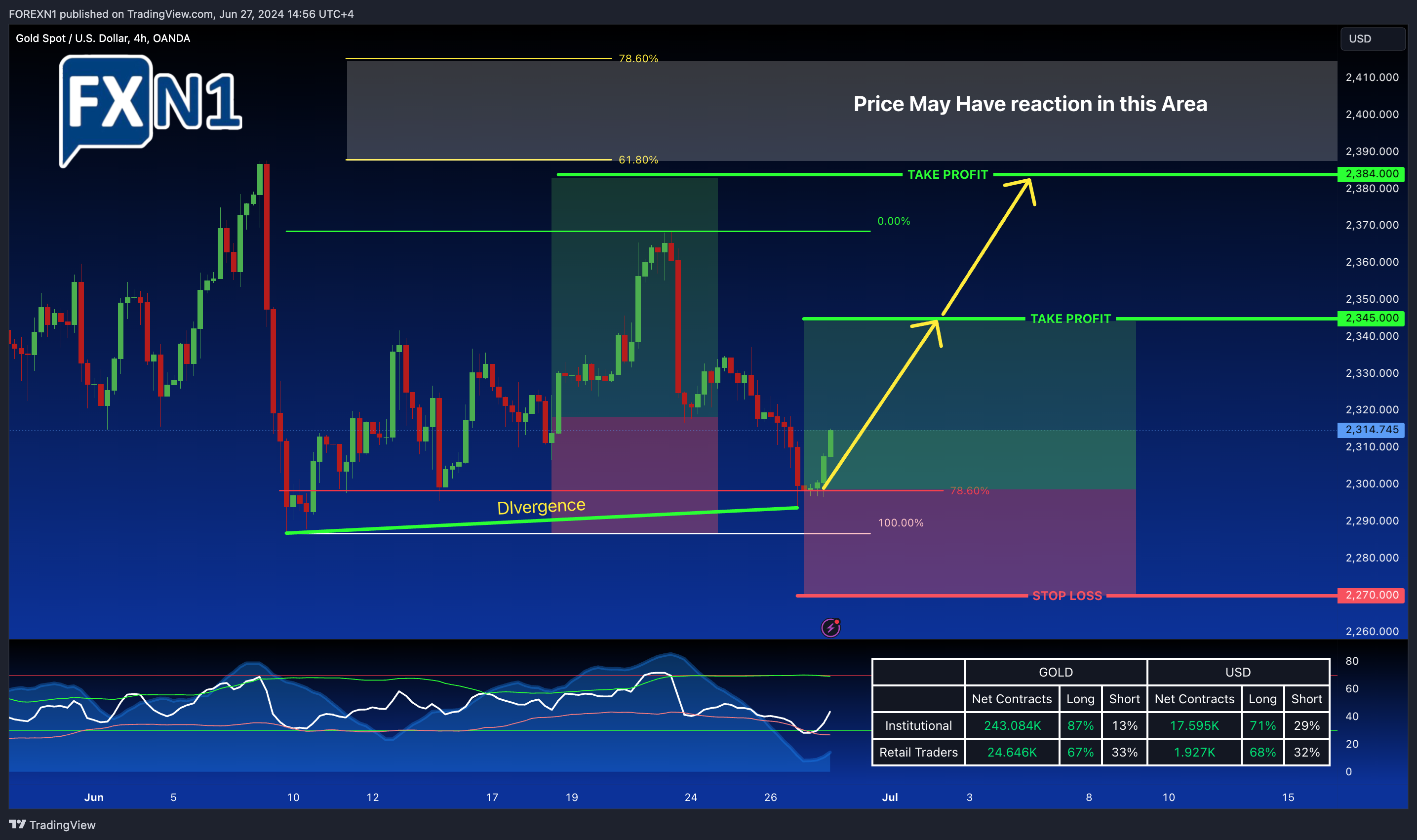 OANDA:XAUUSD Chart Image by FOREXN1