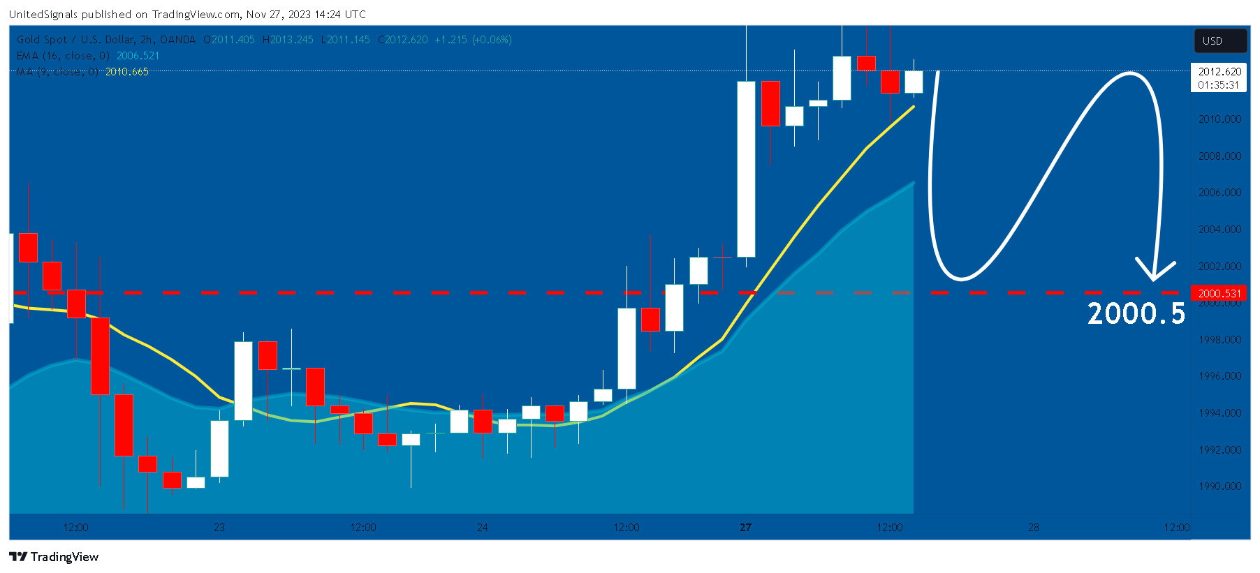 OANDA:XAUUSD Chart Image by UnitedSignals