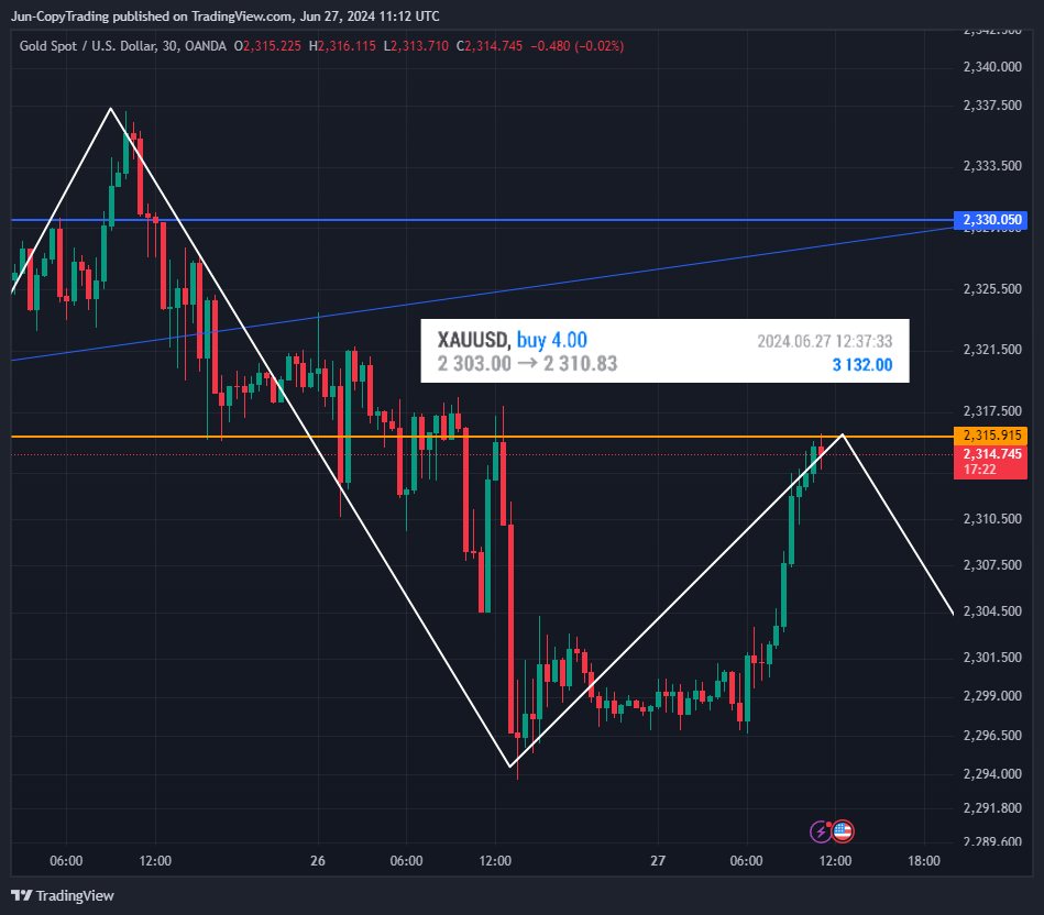 OANDA:XAUUSD Chart Image by GenevieveJulia
