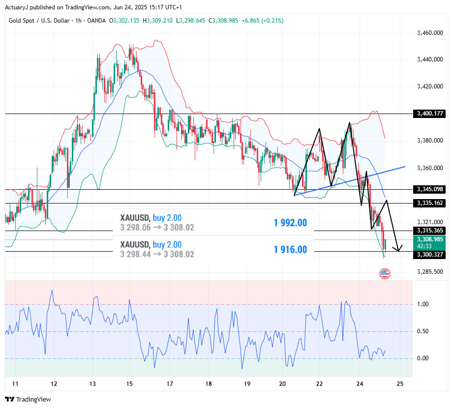 OANDA:XAUUSD Chart Image by ActuaryJ