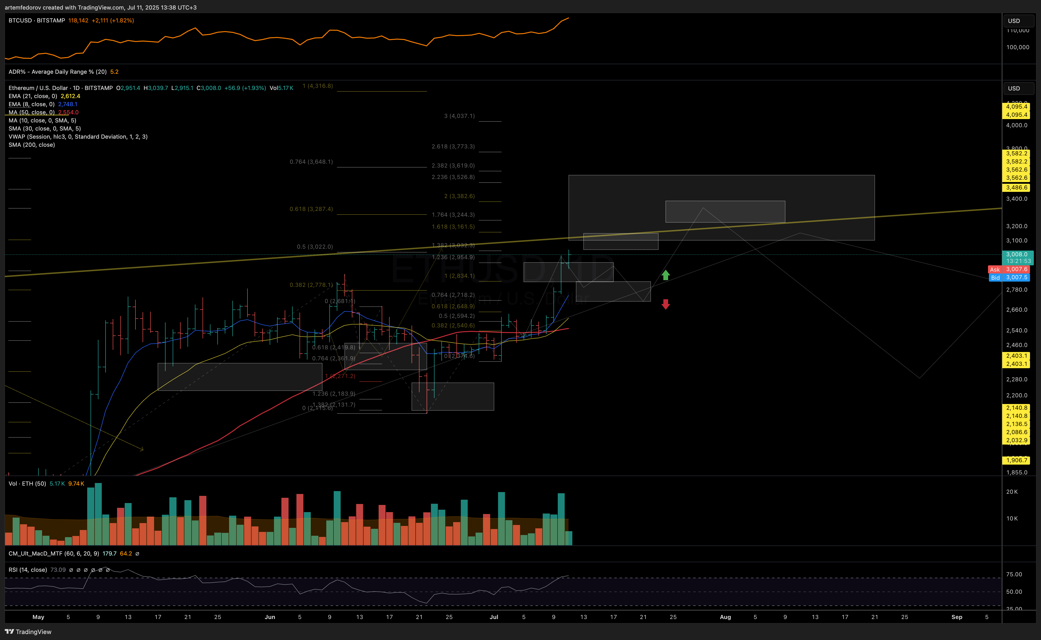 BITSTAMP:ETHUSD Chart Image by artemfedorov