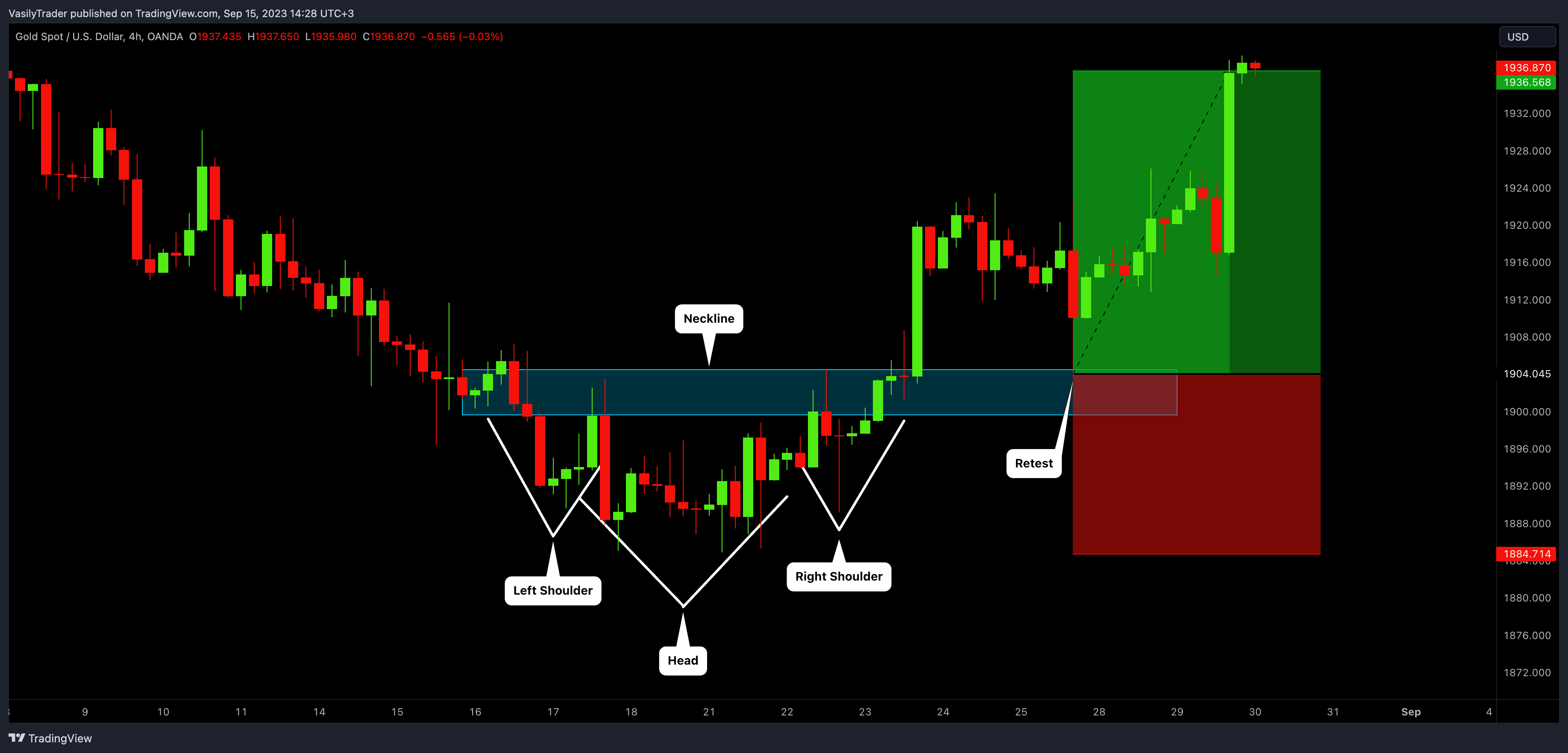 OANDA:XAUUSD Chart Image by VasilyTrader