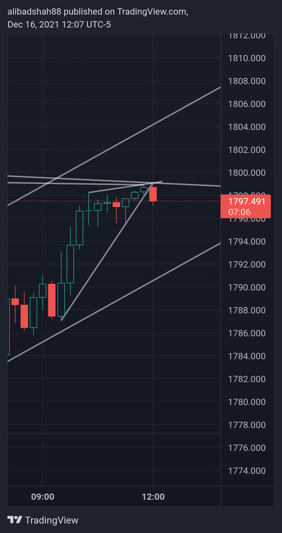 OANDA:XAUUSD Chart Image by alibadshah88