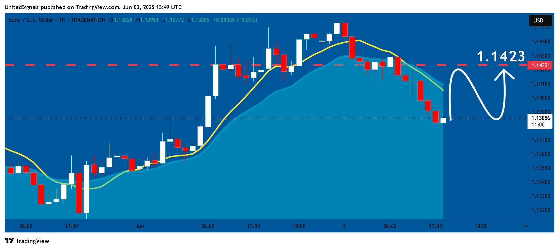 TRADENATION:EURUSD Chart Image by UnitedSignals
