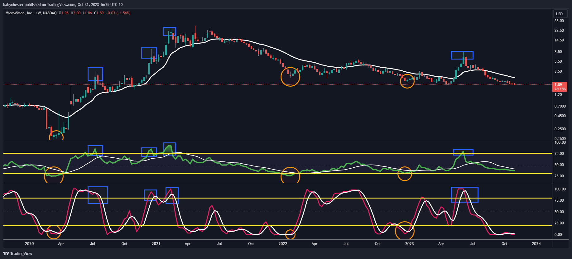 BATS:MVIS Chart Image by babychester