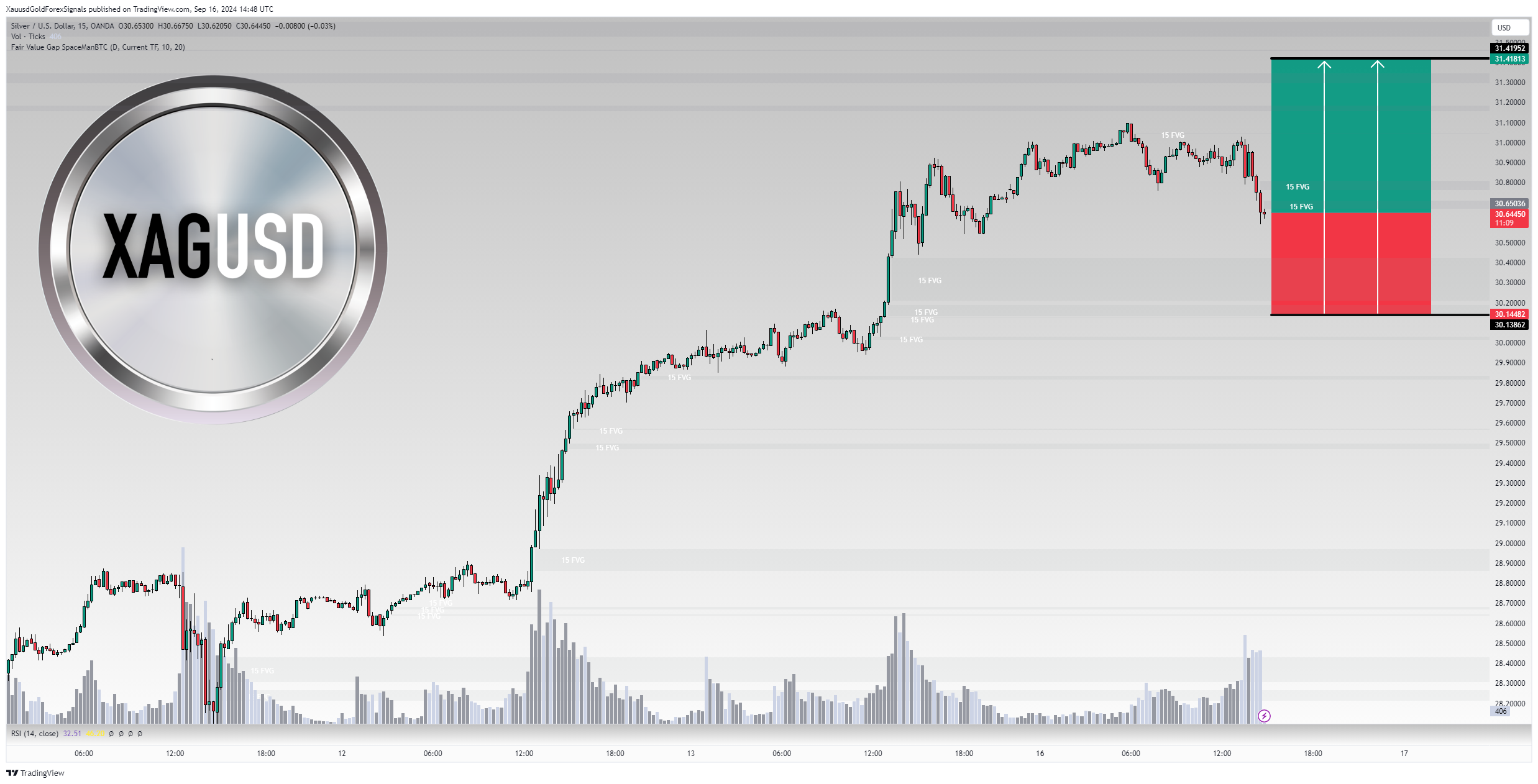 OANDA:XAGUSD Chart Image by XauusdGoldForexSignals