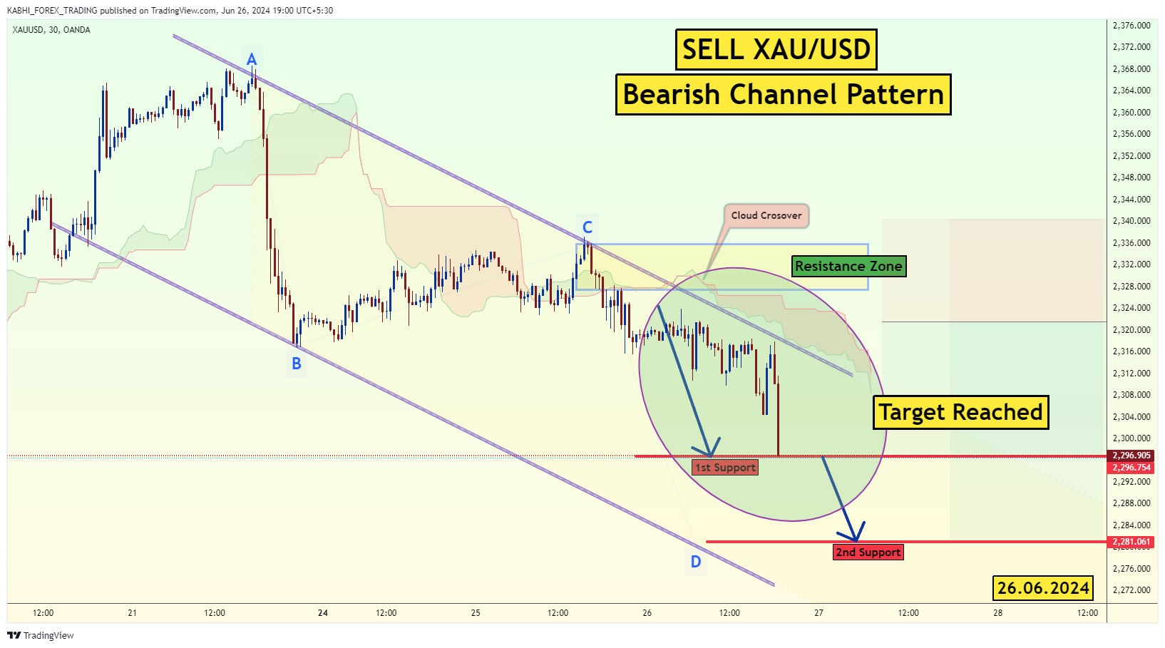 OANDA:XAUUSD Chart Image by KABHI_TA_TRADING