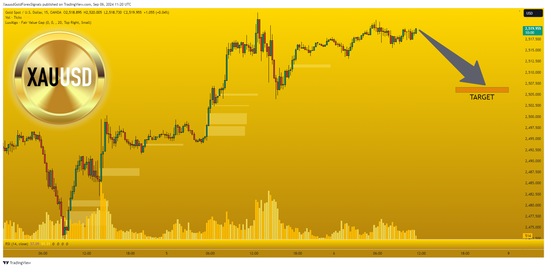 OANDA:XAUUSD Chart Image by XauusdGoldForexSignals