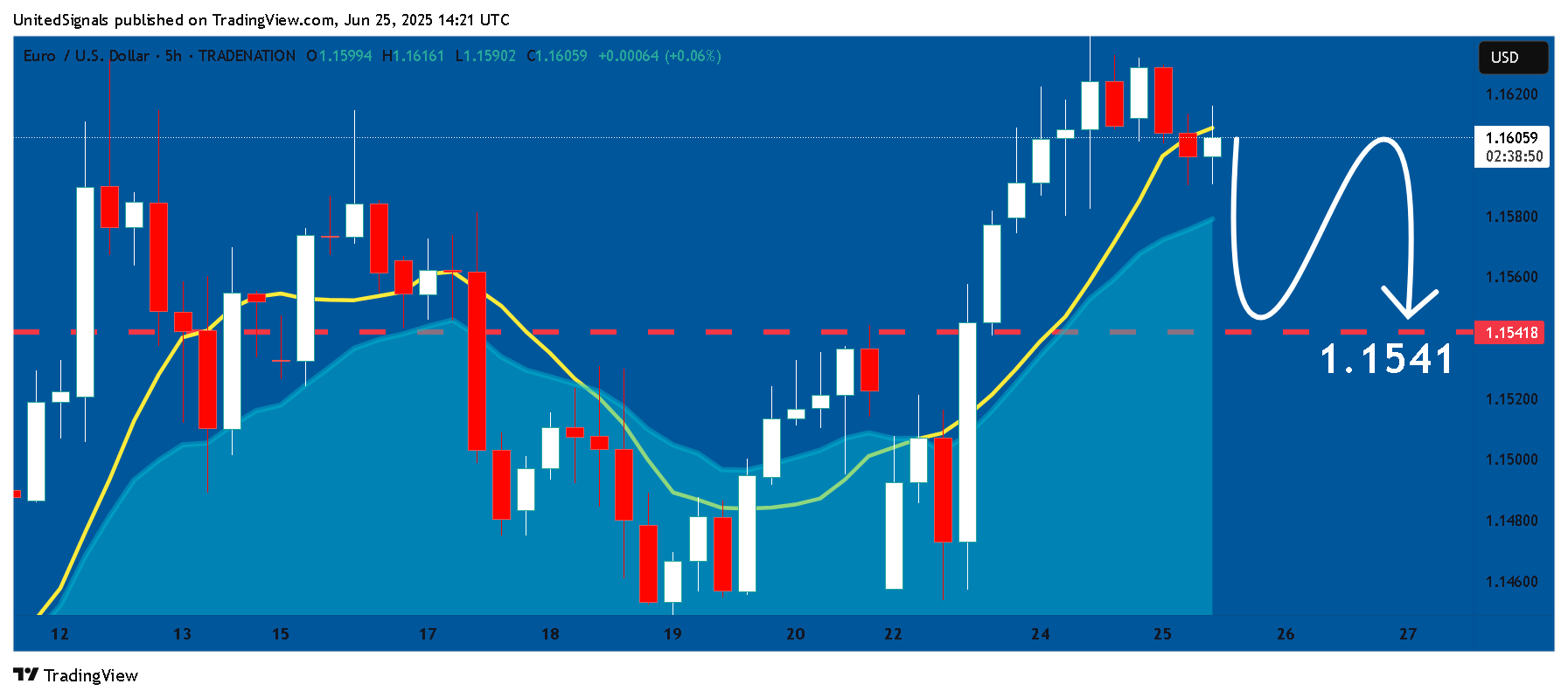 TRADENATION:EURUSD Chart Image by UnitedSignals