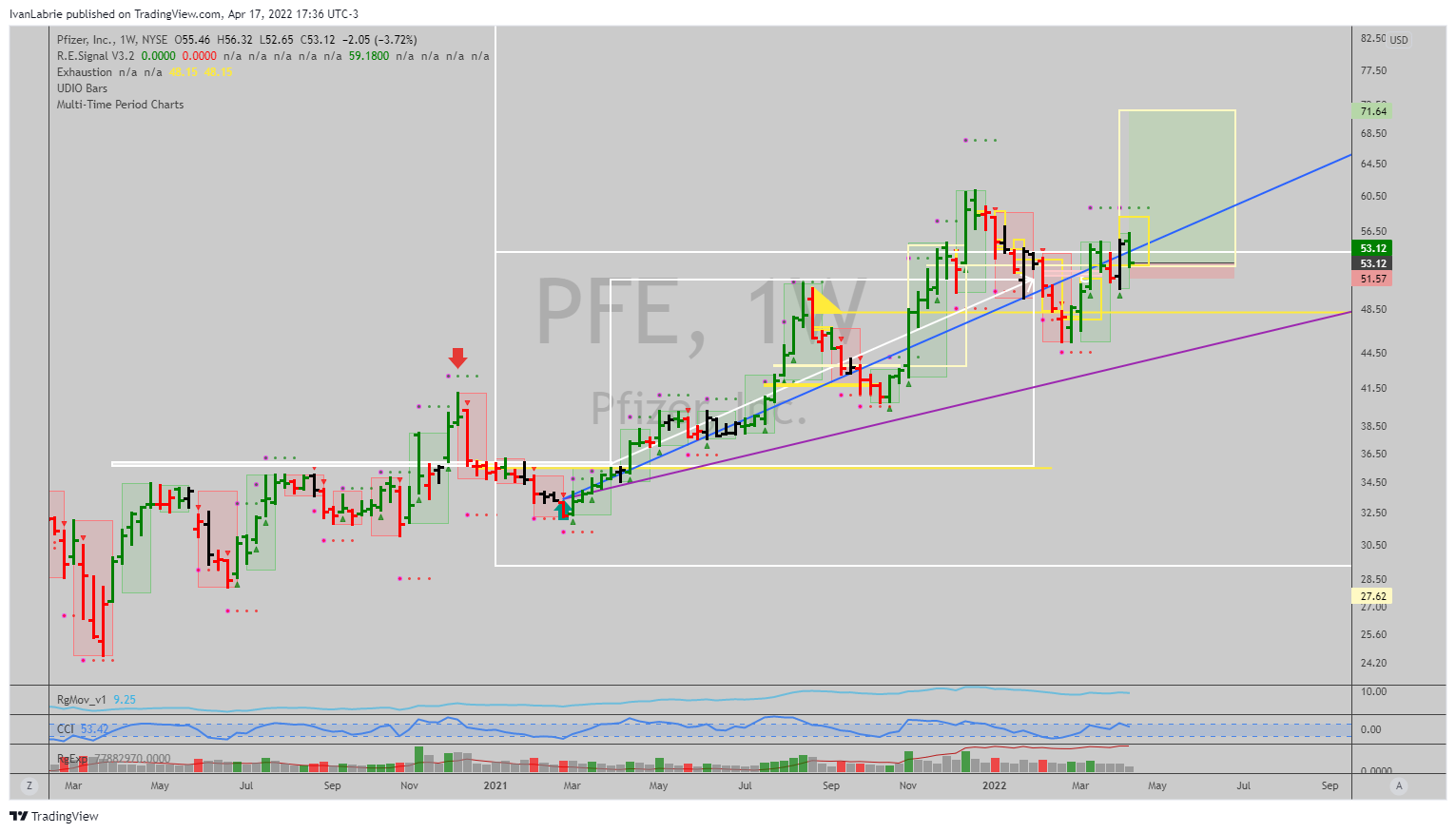 NYSE:PFE Chart Image by IvanLabrie